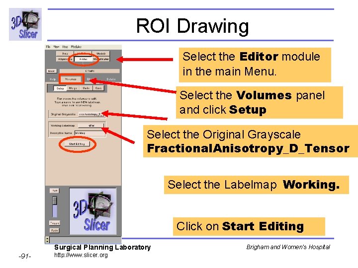 ROI Drawing Select the Editor module in the main Menu. Select the Volumes panel