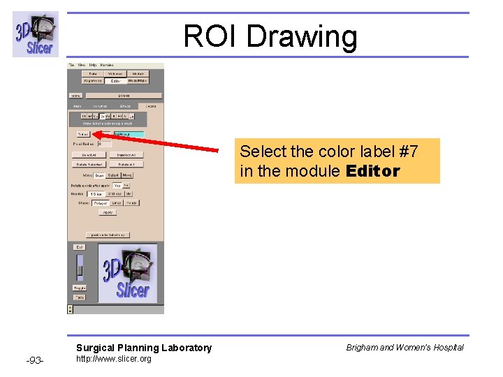 ROI Drawing Select the color label #7 in the module Editor Surgical Planning Laboratory