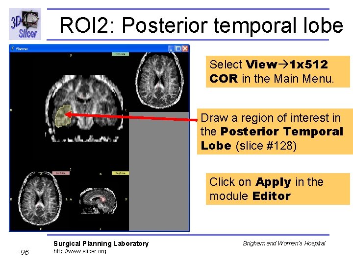 ROI 2: Posterior temporal lobe Select View 1 x 512 COR in the Main