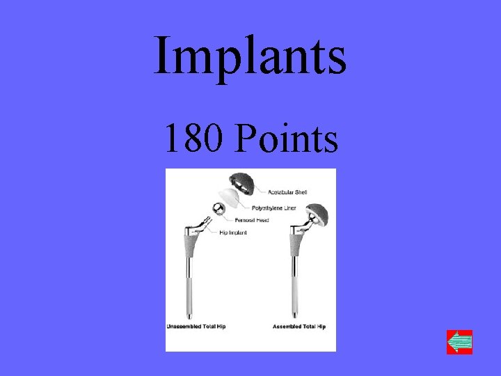 Implants 180 Points 