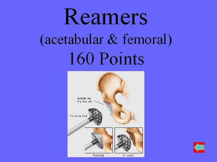 Reamers (acetabular & femoral) 160 Points 