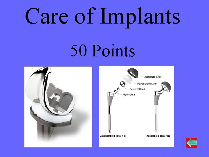 Care of Implants 50 Points 