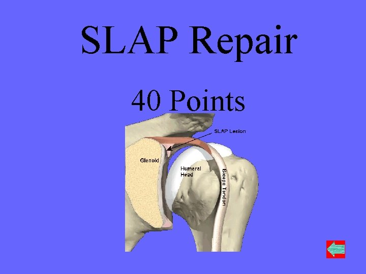 SLAP Repair 40 Points 