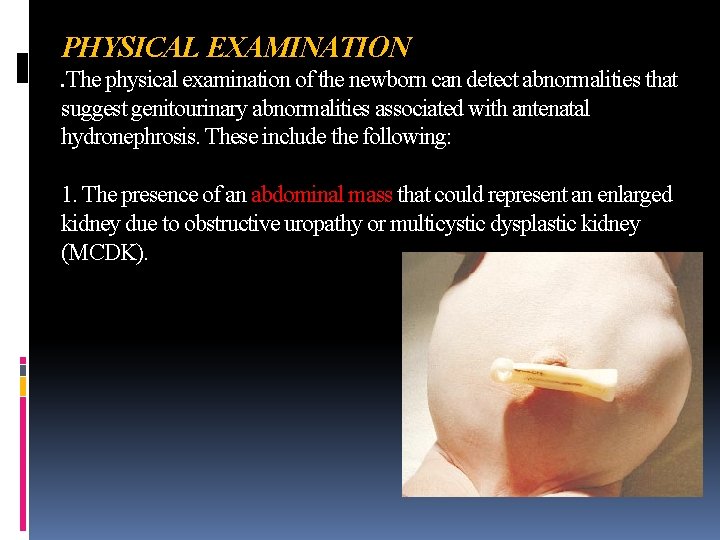 PHYSICAL EXAMINATION. The physical examination of the newborn can detect abnormalities that suggest genitourinary