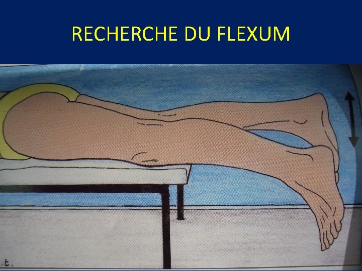 RECHERCHE DU FLEXUM RECHERCHE DU FLEXUM