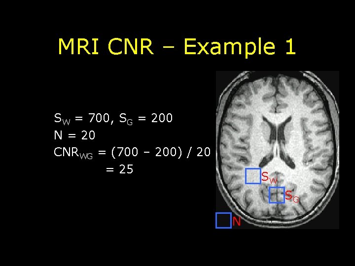 MRI CNR – Example 1 SW = 700, SG = 200 N = 20