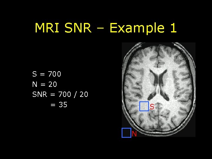 MRI SNR – Example 1 S = 700 N = 20 SNR = 700