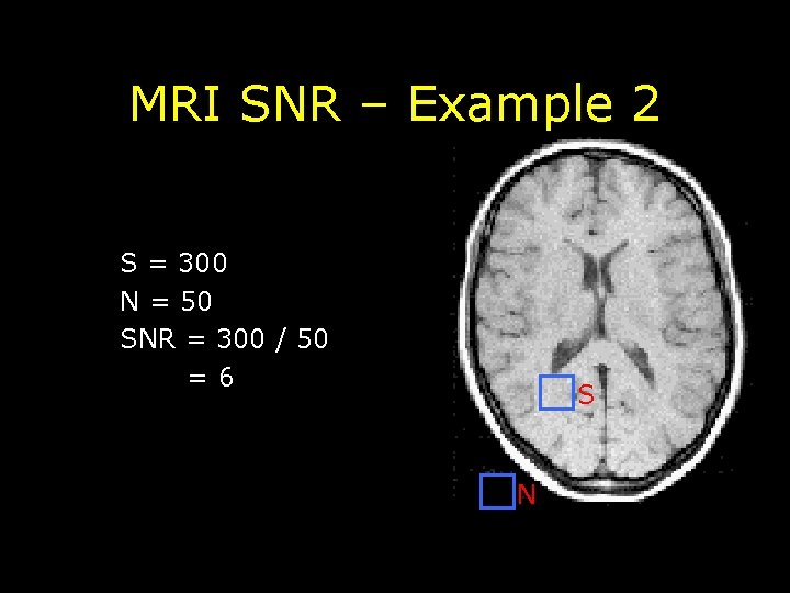 MRI SNR – Example 2 S = 300 N = 50 SNR = 300