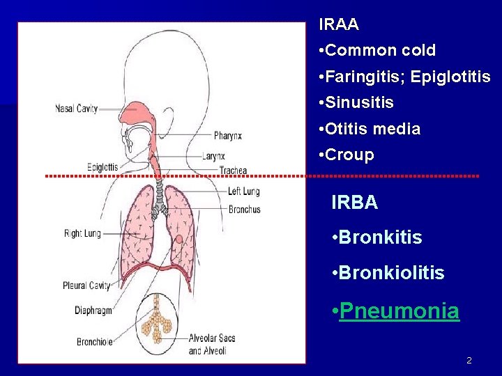 IRAA • Common cold • Faringitis; Epiglotitis • Sinusitis • Otitis media • Croup