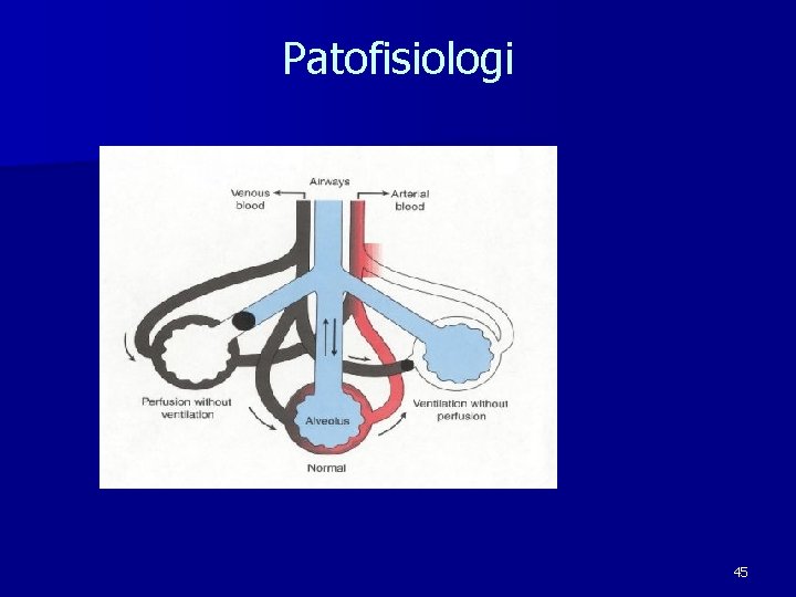 Patofisiologi 45 