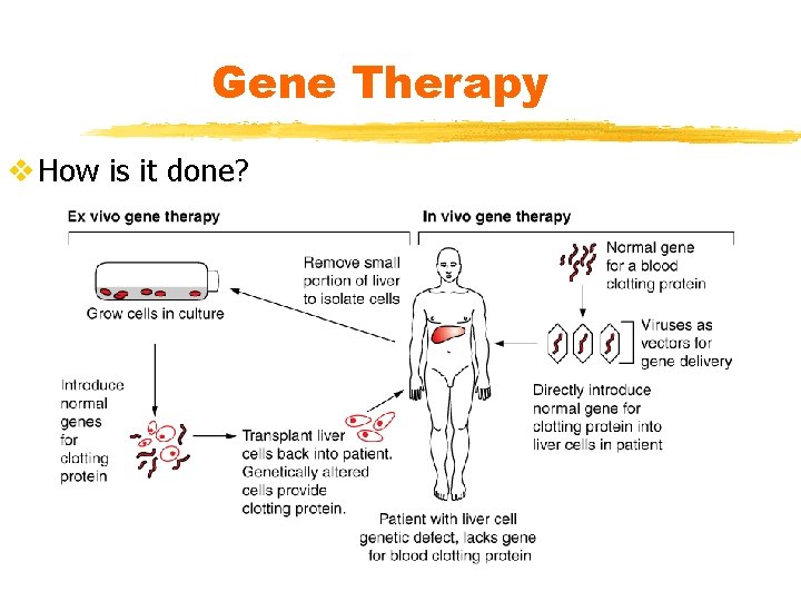 Gene Therapy v How is it done? 