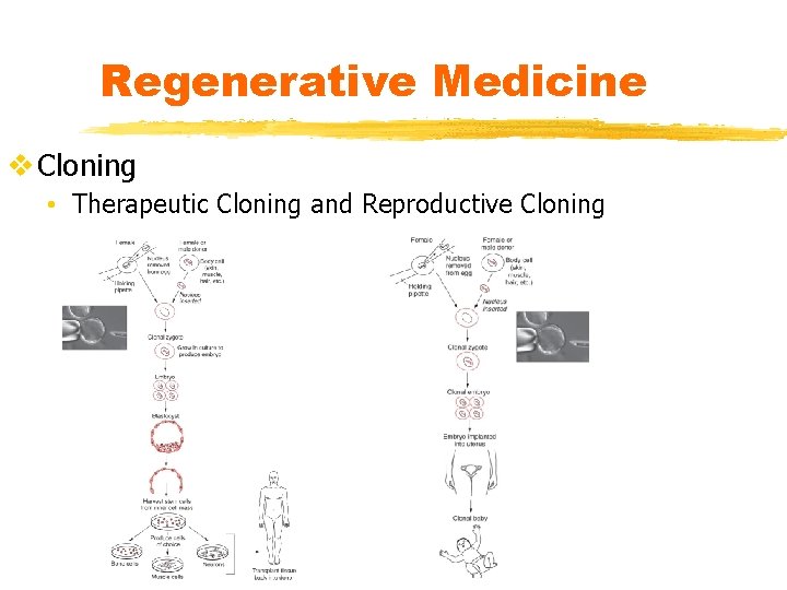 Regenerative Medicine v Cloning • Therapeutic Cloning and Reproductive Cloning 
