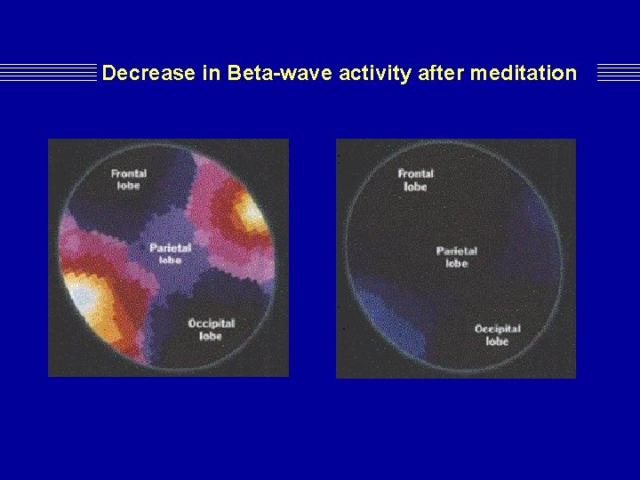 Decrease in Beta-wave activity after meditation Decrease in Beta-wave activity after meditation