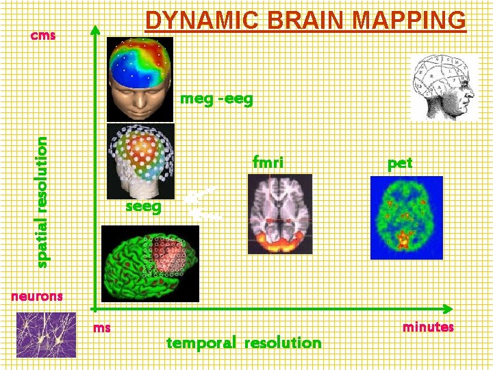 DYNAMIC BRAIN MAPPING cms spatial resolution meg -eeg fmri pet seeg neurons ms temporal DYNAMIC BRAIN MAPPING cms spatial resolution meg -eeg fmri pet seeg neurons ms temporal