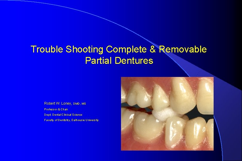 Trouble Shooting Complete & Removable Partial Dentures Robert W. Loney, DMD, MS Professor &