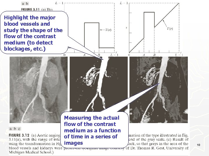 Highlight the major blood vessels and study the shape of the flow of the