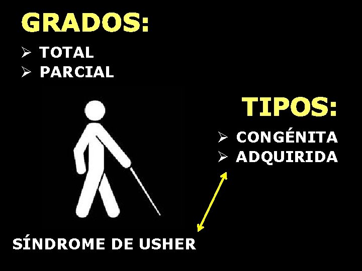 GRADOS: Ø TOTAL Ø PARCIAL TIPOS: Ø CONGÉNITA Ø ADQUIRIDA SÍNDROME DE USHER 