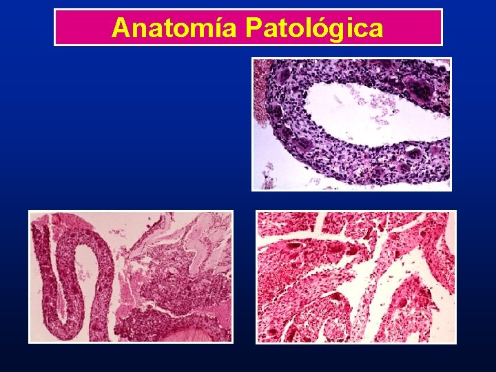 Anatomía Patológica Anatomía Patológica