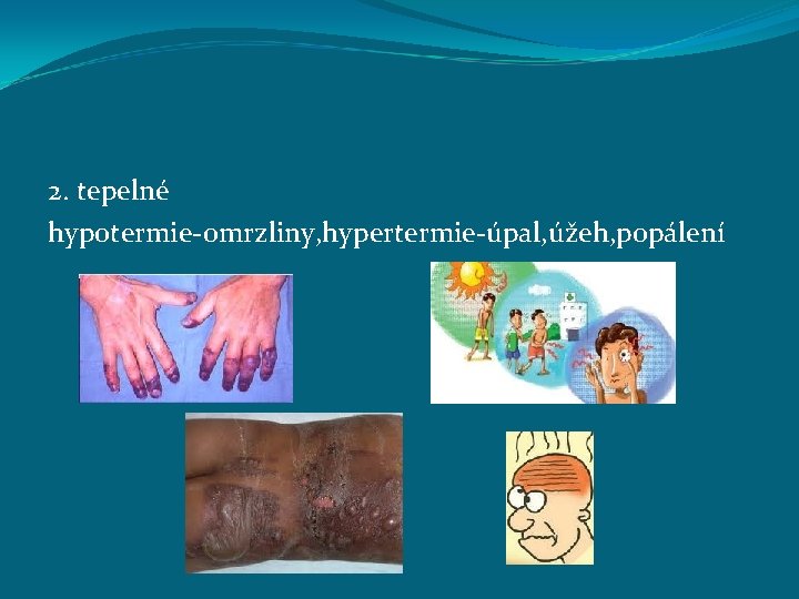 2. tepelné hypotermie-omrzliny, hypertermie-úpal, úžeh, popálení 