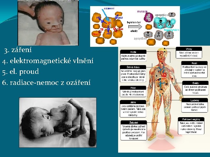 3. záření 4. elektromagnetické vlnění 5. el. proud 6. radiace-nemoc z ozáření 