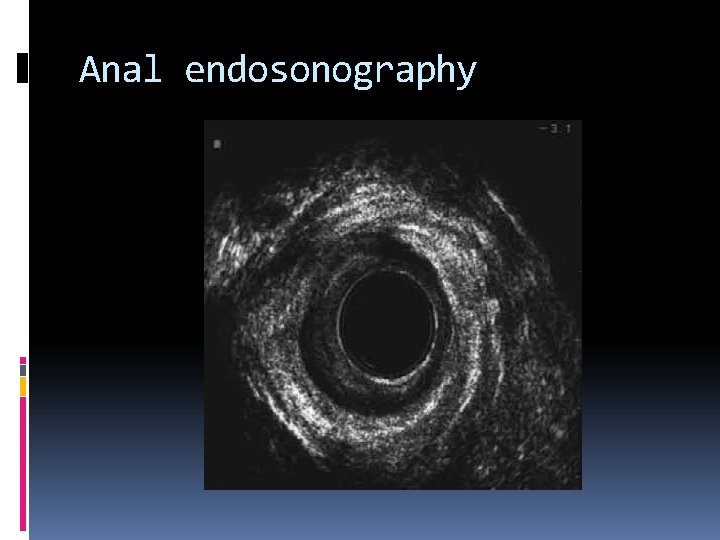 Anal endosonography 