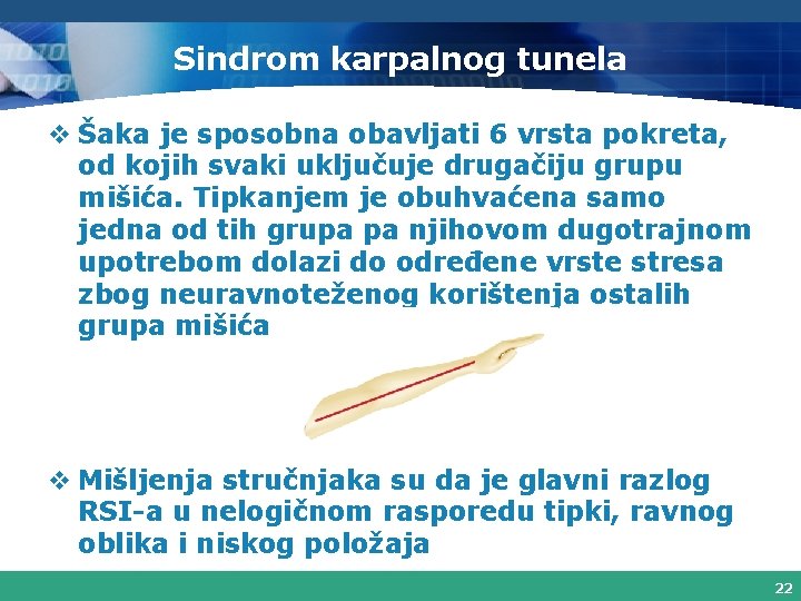 Sindrom karpalnog tunela v Šaka je sposobna obavljati 6 vrsta pokreta, od kojih svaki