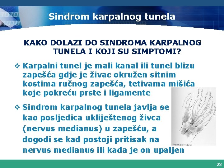 Sindrom karpalnog tunela KAKO DOLAZI DO SINDROMA KARPALNOG TUNELA I KOJI SU SIMPTOMI? v