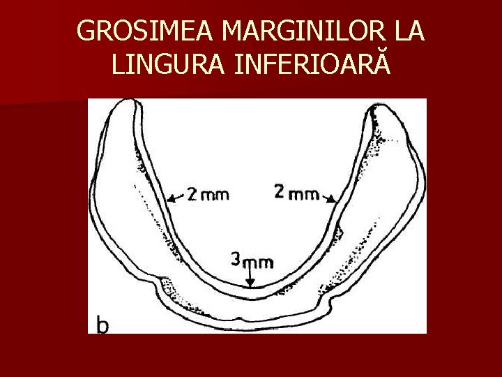 GROSIMEA MARGINILOR LA LINGURA INFERIOARĂ 