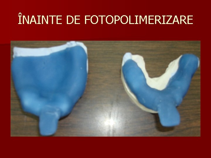 ÎNAINTE DE FOTOPOLIMERIZARE 