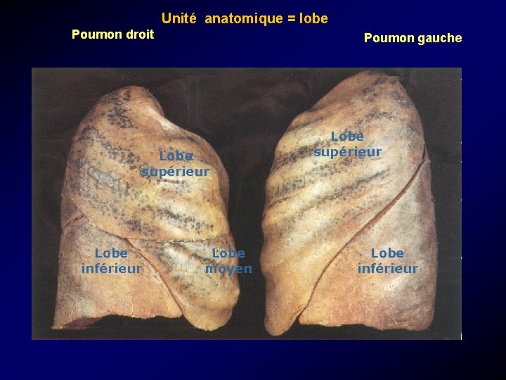 Unité anatomique = lobe Poumon droit Poumon gauche Lobe supérieur Lobe inférieur Lobe moyen