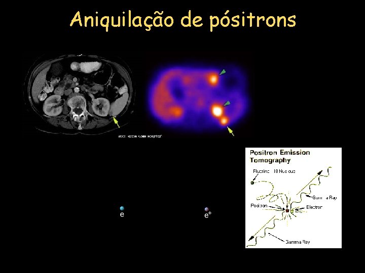 Aniquilação de pósitrons 