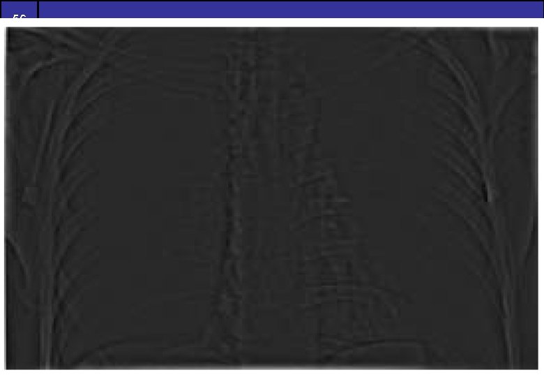 56 of 54 Highpass Filtering Example 56 of 54 Highpass Filtering Example
