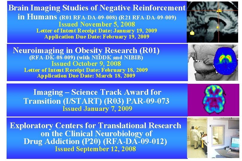 Brain Imaging Studies of Negative Reinforcement in Humans (R 01 RFA-DA-09 -008) (R 21