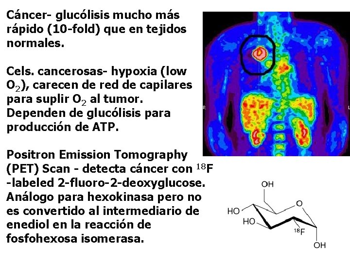 Cáncer- glucólisis mucho más rápido (10 -fold) que en tejidos normales. Cels. cancerosas- hypoxia