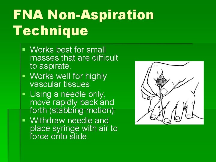 FNA Non-Aspiration Technique § Works best for small masses that are difficult to aspirate.