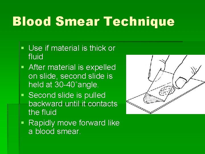 Blood Smear Technique § Use if material is thick or fluid § After material