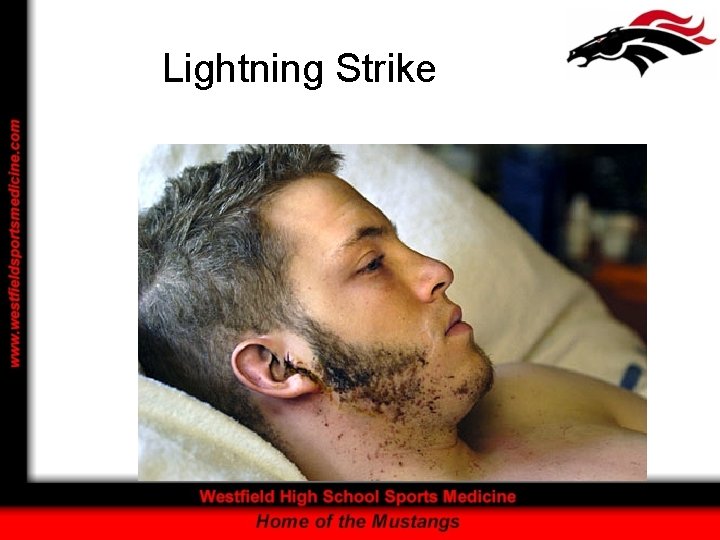 Lightning Strike 
