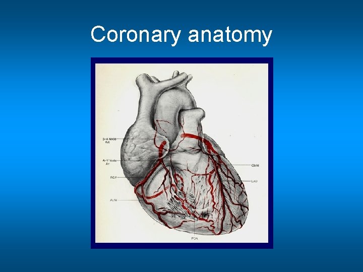 Coronary anatomy 