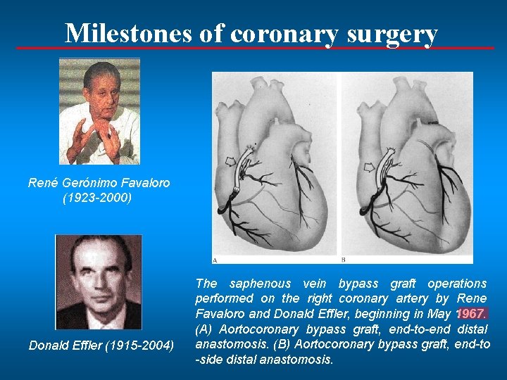 Milestones of coronary surgery René Gerónimo Favaloro (1923 -2000) Donald Effler (1915 -2004) The