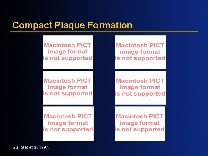 Compact Plaque Formation Guillozet et al, 1997. 