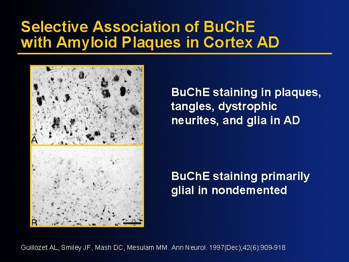 Selective Association of Bu. Ch. E with Amyloid Plaques in Cortex AD Bu. Ch.