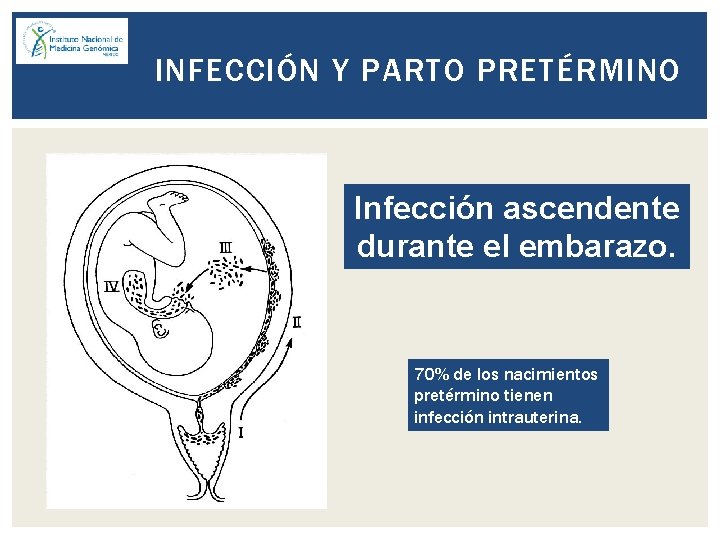 INFECCIÓN Y PARTO PRETÉRMINO Infección ascendente durante el embarazo. 70% de los nacimientos pretérmino