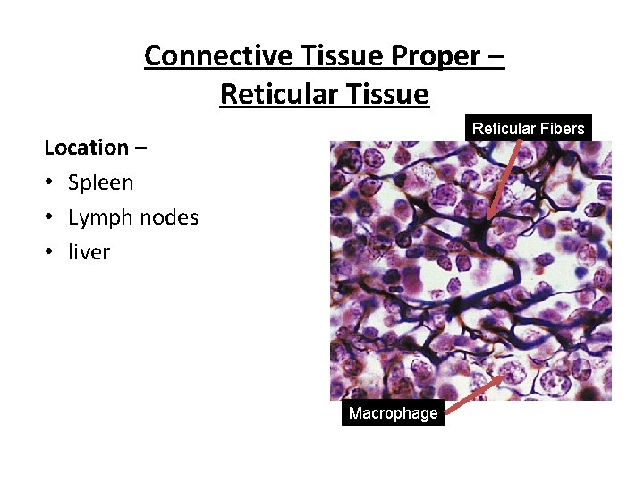 Connective Tissue Proper – Reticular Tissue Reticular Fibers Location – • Spleen • Lymph