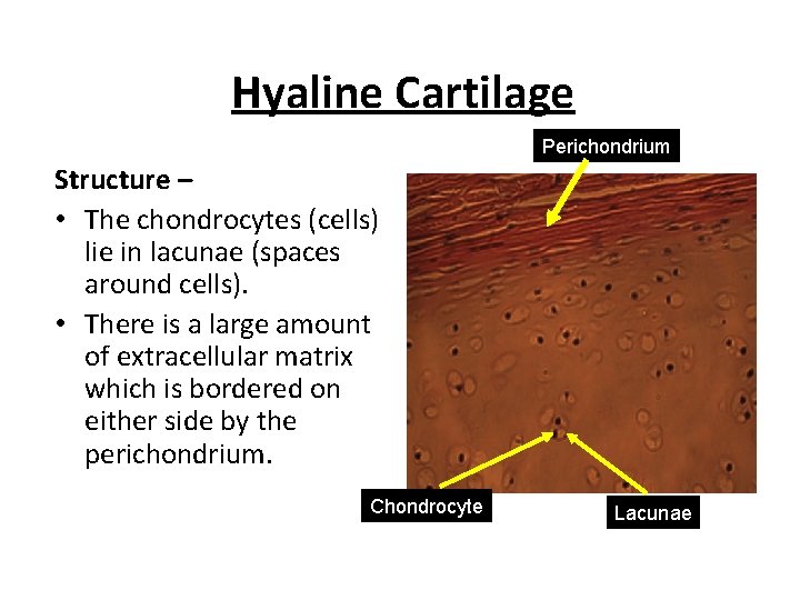 Hyaline Cartilage Perichondrium Structure – • The chondrocytes (cells) lie in lacunae (spaces around