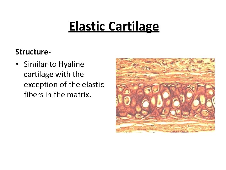 Elastic Cartilage Structure • Similar to Hyaline cartilage with the exception of the elastic