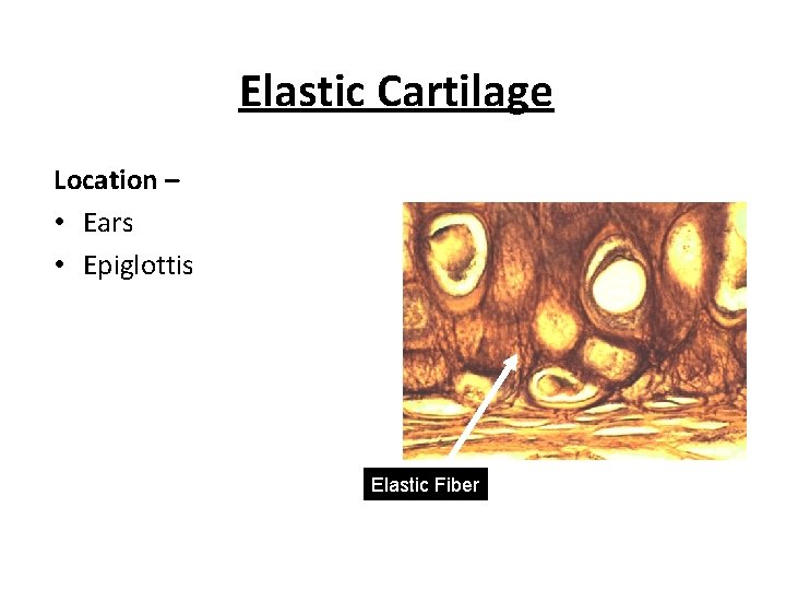 Elastic Cartilage Location – • Ears • Epiglottis Elastic Fiber 