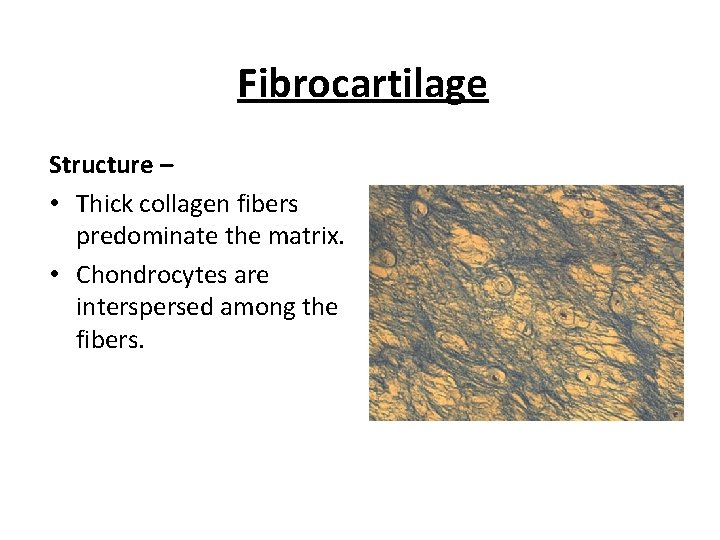 Fibrocartilage Structure – • Thick collagen fibers predominate the matrix. • Chondrocytes are interspersed