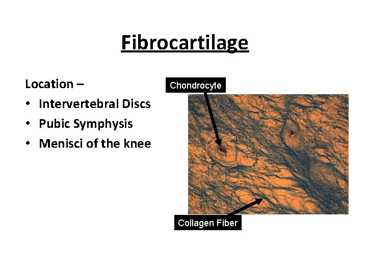 Fibrocartilage Location – • Intervertebral Discs • Pubic Symphysis • Menisci of the knee