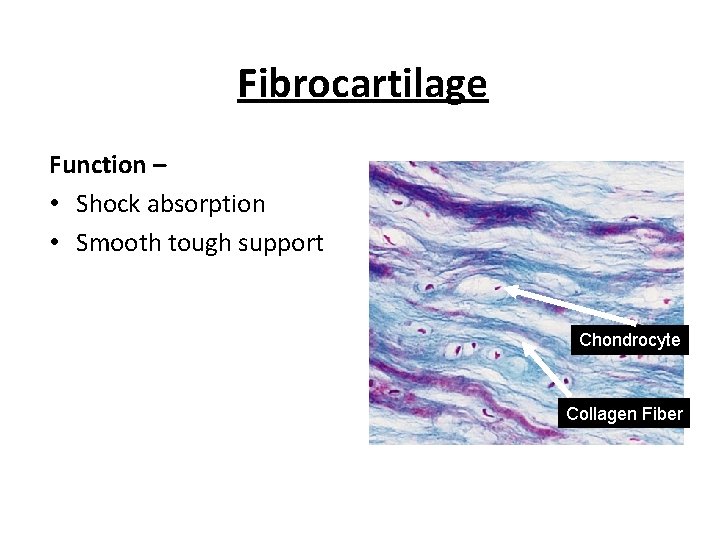 Fibrocartilage Function – • Shock absorption • Smooth tough support Chondrocyte Collagen Fiber 