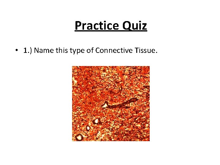 Practice Quiz • 1. ) Name this type of Connective Tissue. 